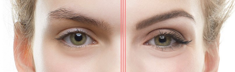 Before and after wax picture of a pair of eyebrows
